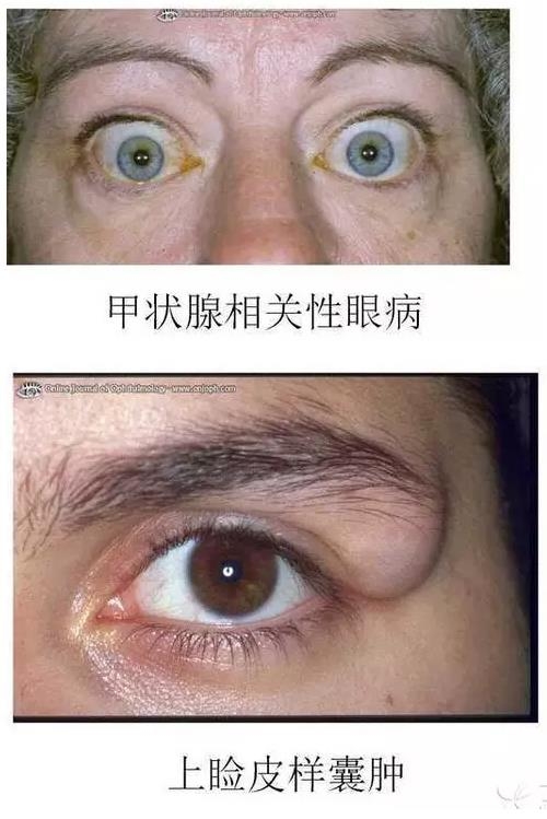 ����Ĥ����������Ĥ��������ͼ��