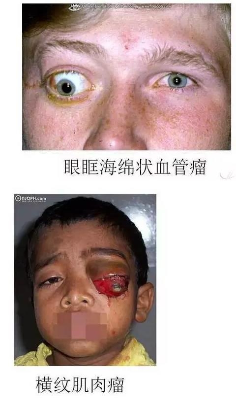 ����Ĥ����������Ĥ��������ͼ��