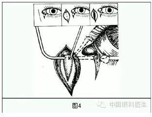 ����ȫ���̣���С�ܶ��ѷ����