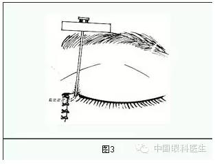 ����ȫ���̣���С�ܶ��ѷ����