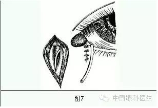 ����ȫ���̣���С�ܶ��ѷ����