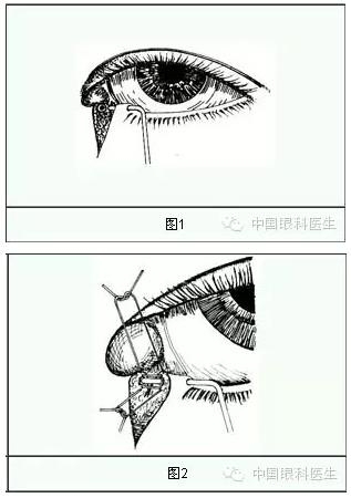 ����ȫ���̣���С�ܶ��ѷ����