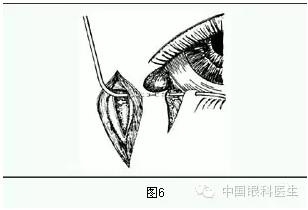 ����ȫ���̣���С�ܶ��ѷ����