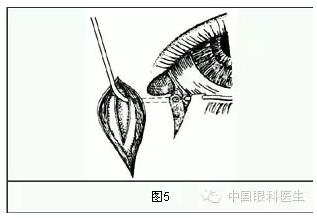 ����ȫ���̣���С�ܶ��ѷ����