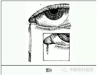 ����ȫ���̣���С�ܶ��ѷ����