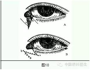 ����ȫ���̣���С�ܶ��ѷ����