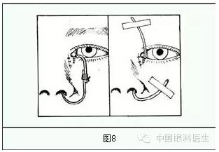 ����ȫ���̣���С�ܶ��ѷ����