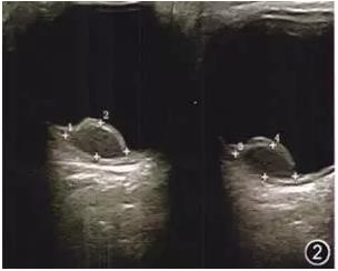 ��������������Ĥƽ������һ��