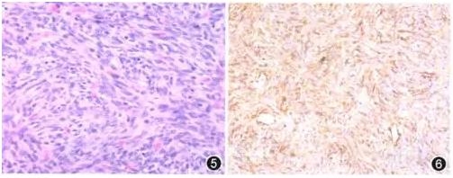 ��������������Ĥƽ������һ��