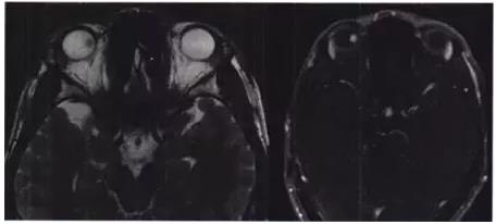 ��������������Ĥƽ������һ��