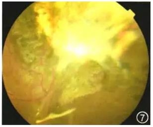 ��������������Ĥƽ������һ��