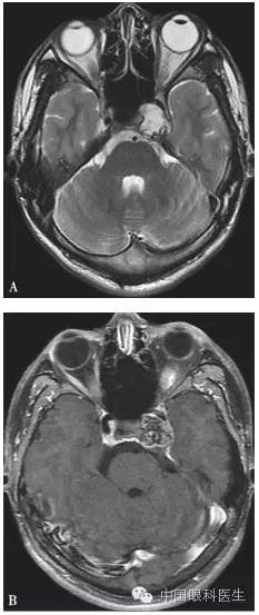 ���������������ۼ����һ��