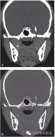 ���������������ۼ����һ��