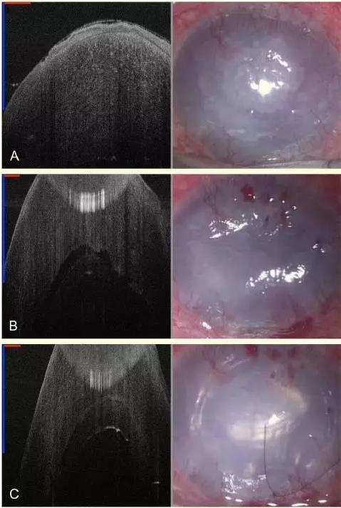 ������������MIOCT�¿�չ DSAEK ����