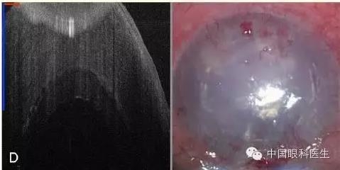 ������������MIOCT�¿�չ DSAEK ����