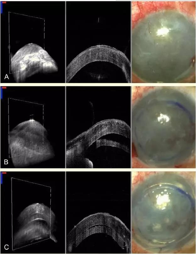 ������������MIOCT�¿�չ DSAEK ����