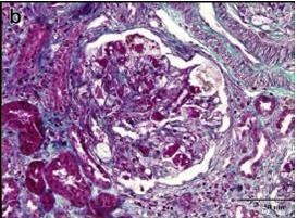 �����������裺�����ۺ������Ĥ����