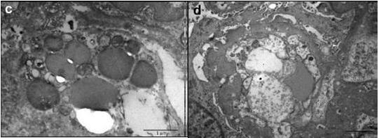 �����������裺�����ۺ������Ĥ����