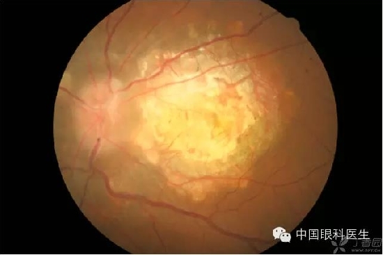 ��ͬ�۲��ĸ����۵�Ƭ