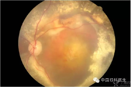 ��ͬ�۲��ĸ����۵�Ƭ