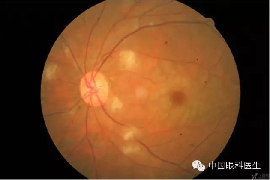 ��ͬ�۲��ĸ����۵�Ƭ