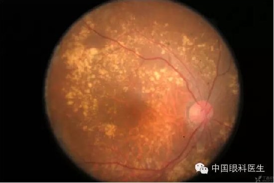 ��ͬ�۲��ĸ����۵�Ƭ