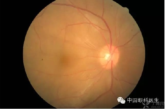 ��ͬ�۲��ĸ����۵�Ƭ