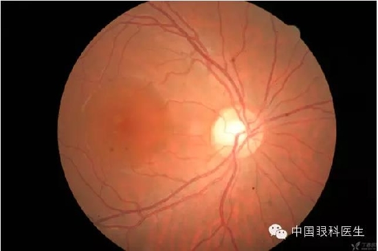 ��ͬ�۲��ĸ����۵�Ƭ