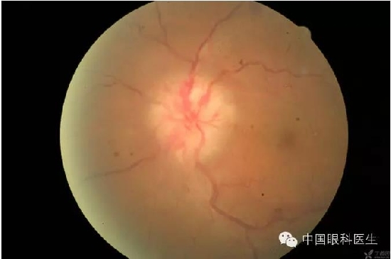 ��ͬ�۲��ĸ����۵�Ƭ