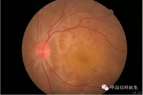 ��ͬ�۲��ĸ����۵�Ƭ