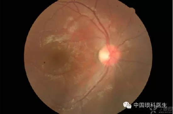 ��ͬ�۲��ĸ����۵�Ƭ