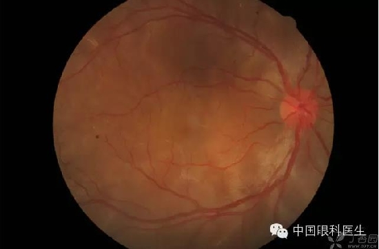 ��ͬ�۲��ĸ����۵�Ƭ