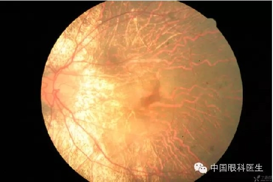 ��ͬ�۲��ĸ����۵�Ƭ