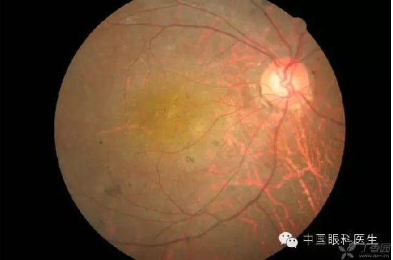 ��ͬ�۲��ĸ����۵�Ƭ