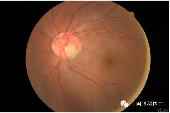 ��ͬ�۲��ĸ����۵�Ƭ