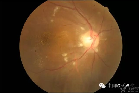 ��ͬ�۲��ĸ����۵�Ƭ