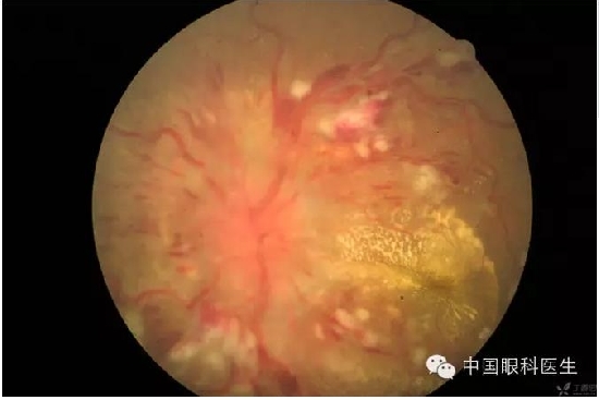 ��ͬ�۲��ĸ����۵�Ƭ