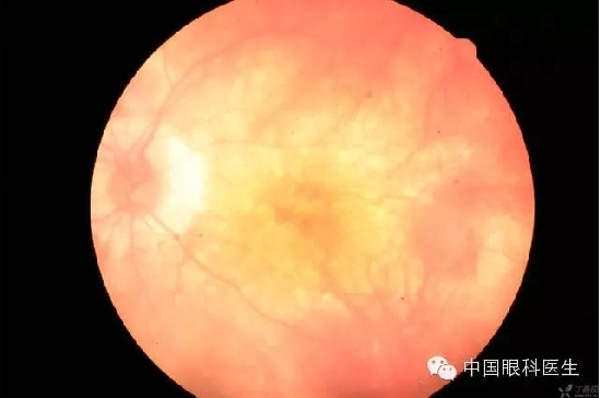 ��ͬ�۲��ĸ����۵�Ƭ