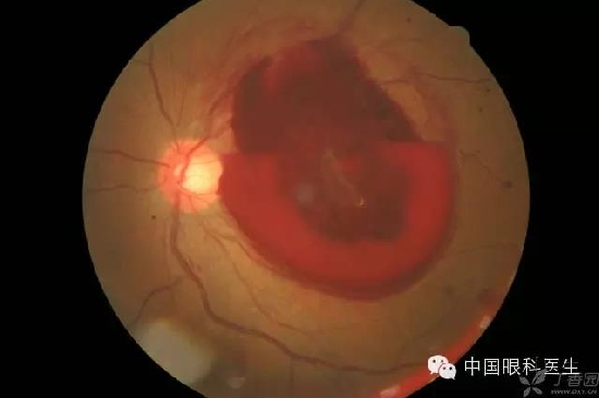 ��ͬ�۲��ĸ����۵�Ƭ