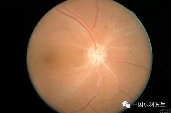 ��ͬ�۲��ĸ����۵�Ƭ