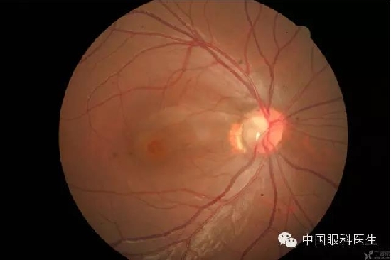 ��ͬ�۲��ĸ����۵�Ƭ