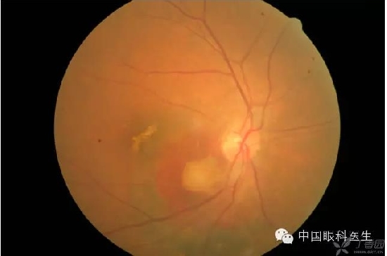 ��ͬ�۲��ĸ����۵�Ƭ