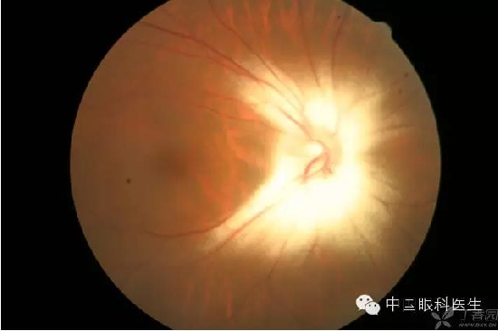 ��ͬ�۲��ĸ����۵�Ƭ