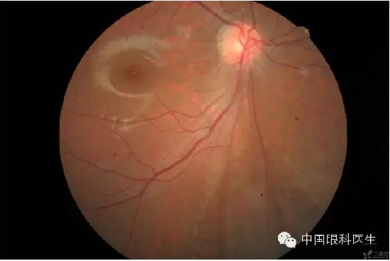 ��ͬ�۲��ĸ����۵�Ƭ