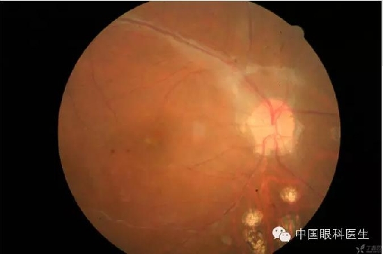 ��ͬ�۲��ĸ����۵�Ƭ