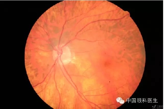 ��ͬ�۲��ĸ����۵�Ƭ