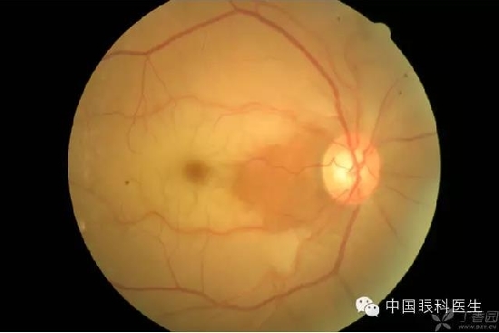 ��ͬ�۲��ĸ����۵�Ƭ