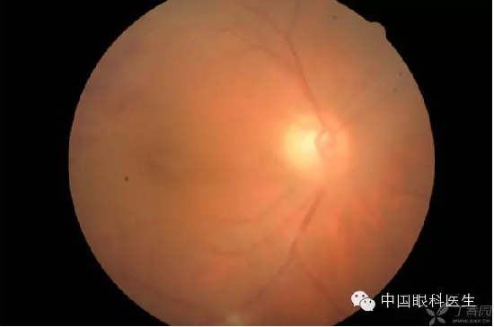 ��ͬ�۲��ĸ����۵�Ƭ