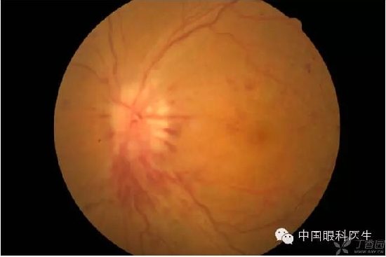 ��ͬ�۲��ĸ����۵�Ƭ