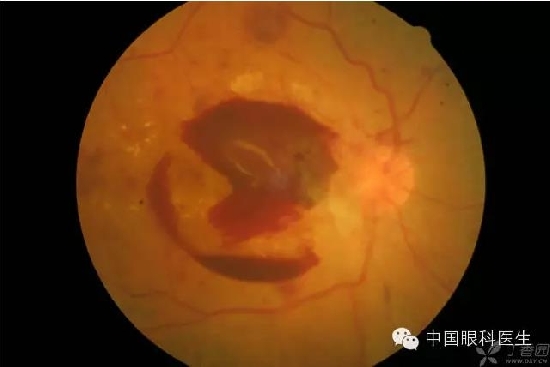 ��ͬ�۲��ĸ����۵�Ƭ